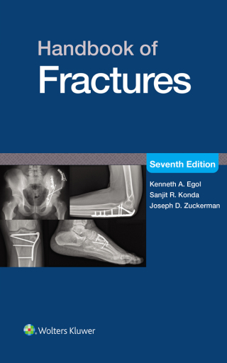 Handbook of Fractures