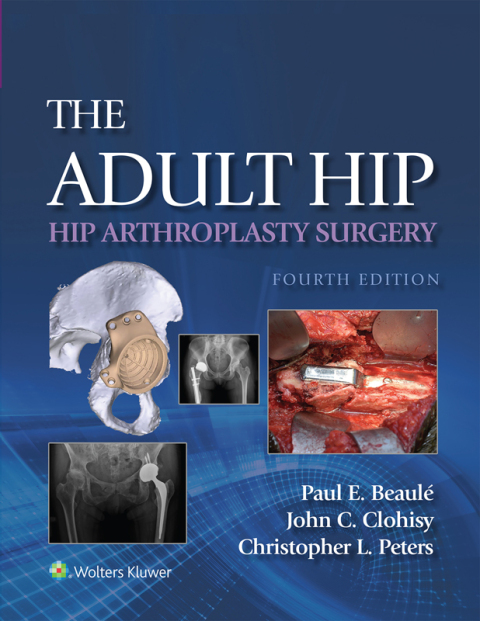 Cover image for book The Adult Hip: Hip Arthroplasty Surgery
