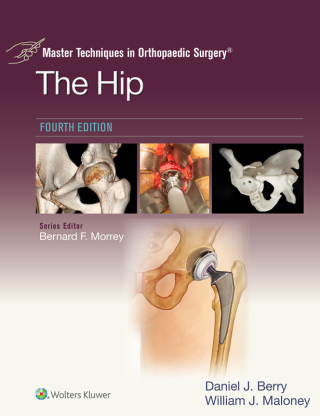 Master Techniques in Orthopaedic Surgery: The Hip