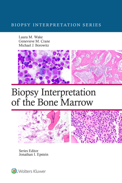 Cover image for book Biopsy Interpretation of the Bone Marrow