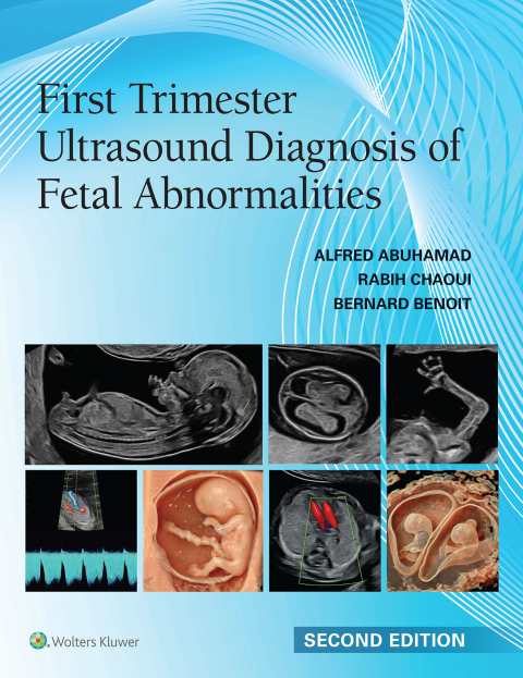 Cover image for book First Trimester Ultrasound Diagnosis of Fetal Abnormalities