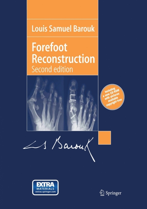 Cover image for book Forefoot Reconstruction