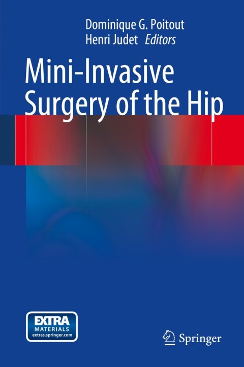 Cover image for book Mini-Invasive Surgery of the Hip