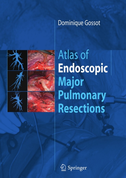 Cover image for book Atlas of endoscopic major pulmonary resections