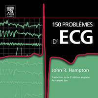 Titelbild: 150 problèmes d'ECG 3rd edition 9782810101498