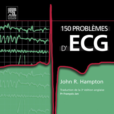 Cover image for book 150 problèmes d'ECG