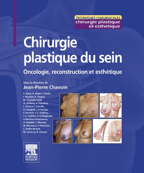 Cover image for book Chirurgie plastique du sein