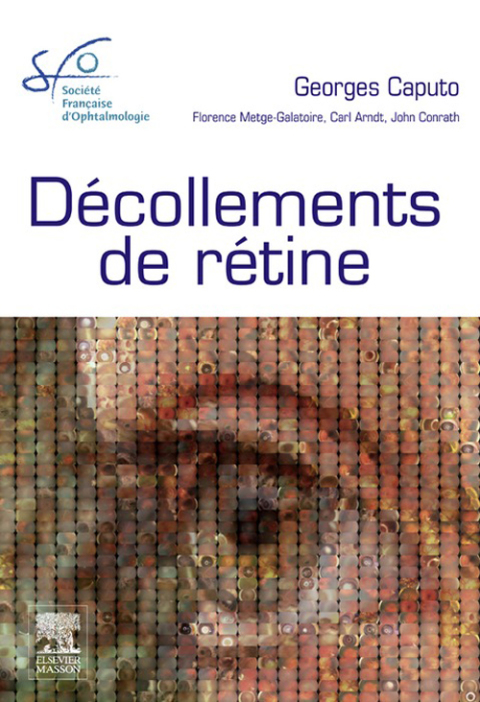 Cover image for book Décollements de rétine