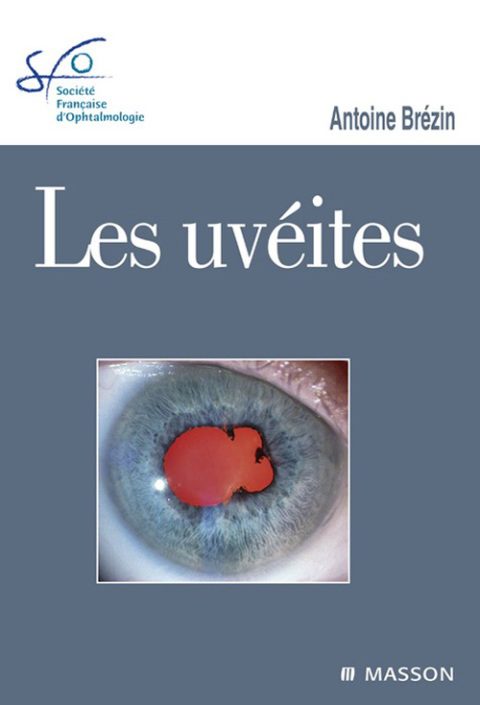 Cover image for book Les uvéites