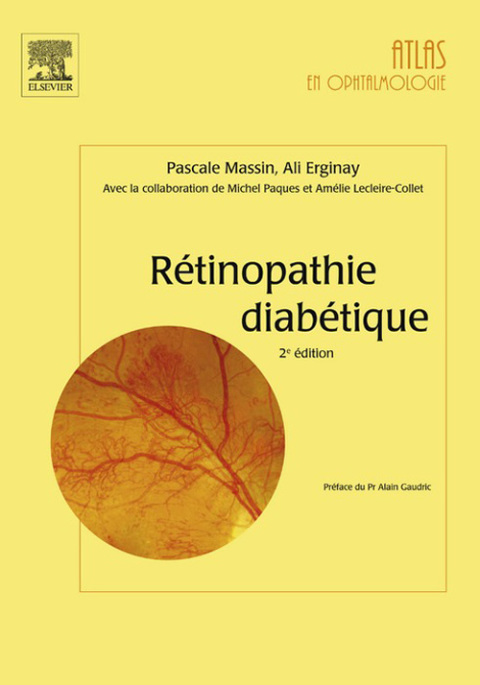 Cover image for book Rétinopathie diabétique