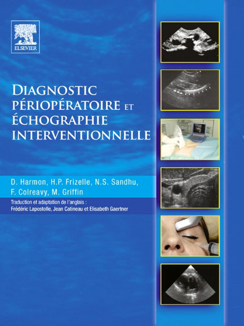 Cover image for book Diagnostic périopératoire et échographie interventionnelle