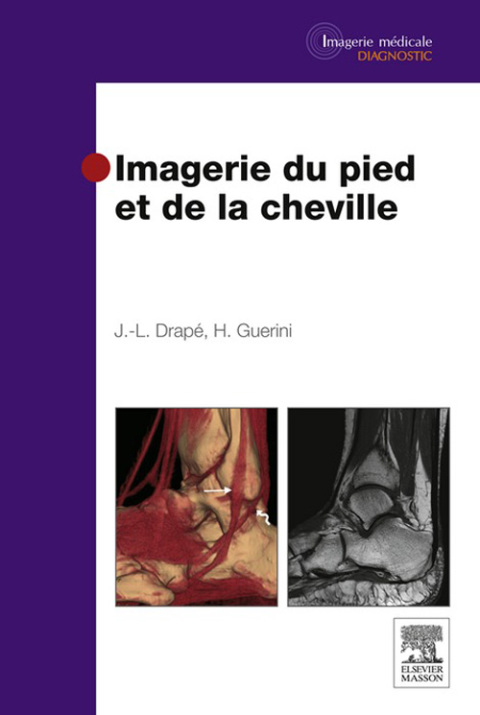 Cover image for book Imagerie du pied et de la cheville