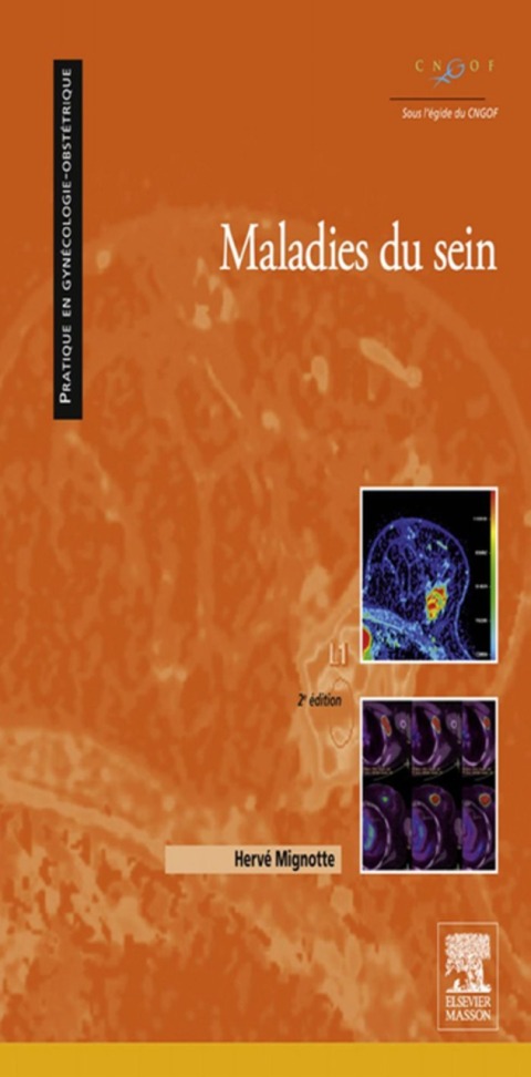 Cover image for book Maladies du sein