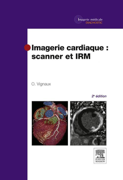 Cover image for book Imagerie cardiaque : scanner et IRM
