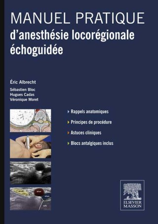 Manuel pratique d’anesthésie locorégionale échoguidée