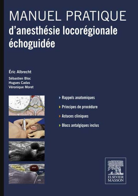 Manuel pratique d?anesthésie locorégionale échoguidée 