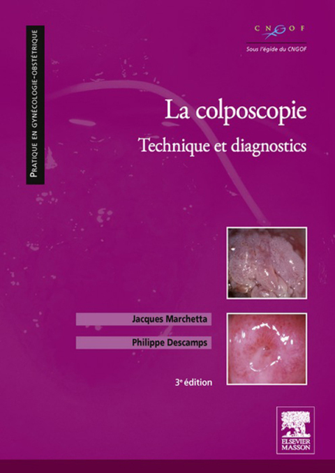 Cover image for book La colposcopie