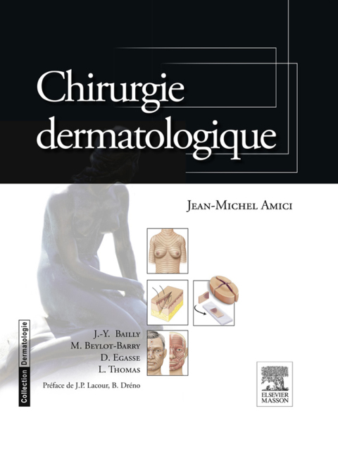 Cover image for book Chirurgie dermatologique