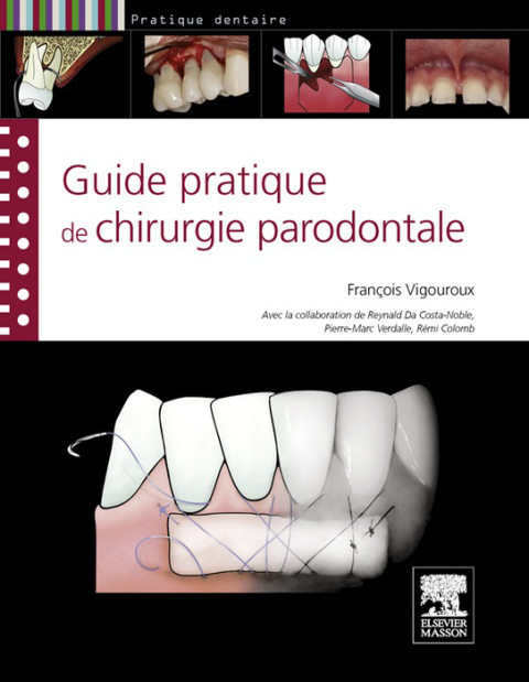 Cover image for book Guide pratique de chirurgie parodontale