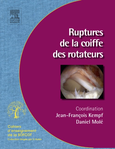 Cover image for book Ruptures de la coiffe des rotateurs