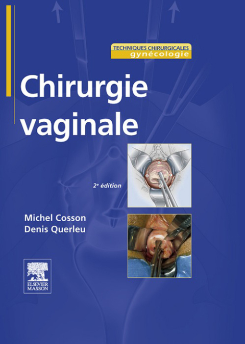 Cover image for book Chirurgie vaginale