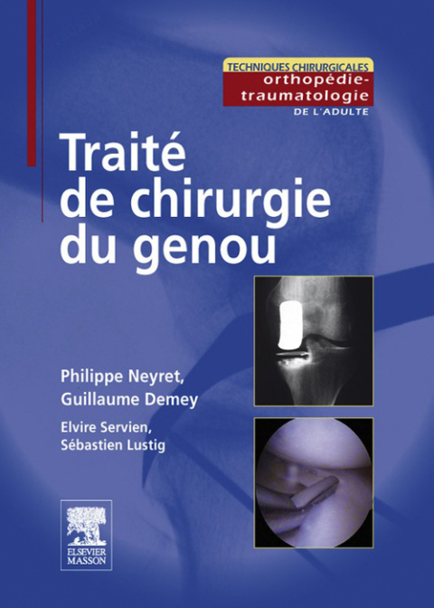 Cover image for book Traité de chirurgie du genou