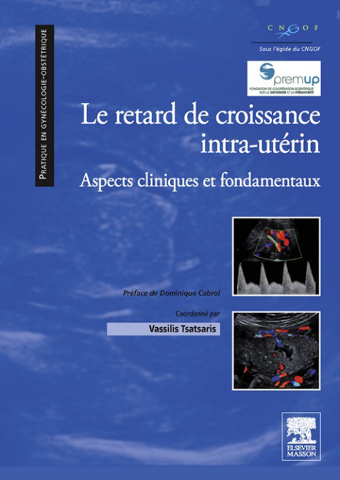 Cover image for book Le retard de croissance intra-utérin