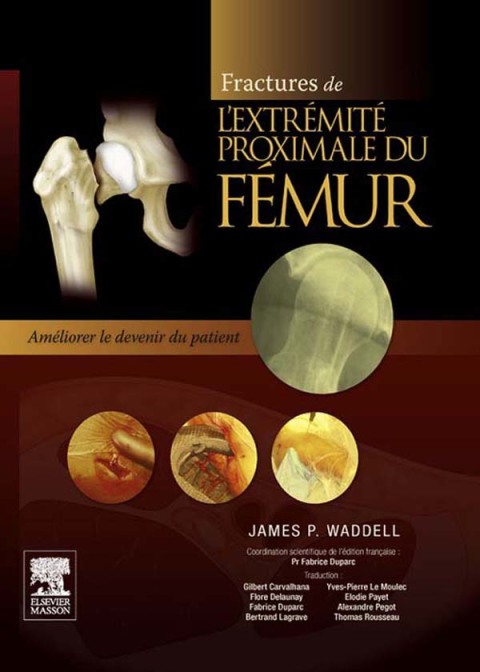 Cover image for book Fractures de l'extrémité proximale du fémur