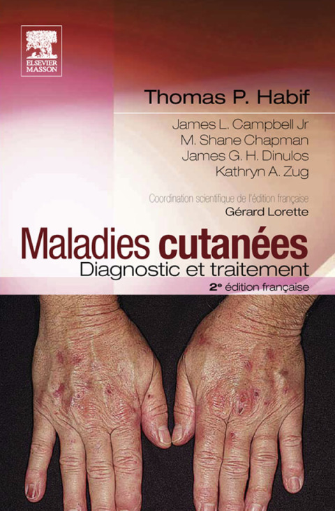 Maladies cutanÃ©es : diagnostic et traitement 