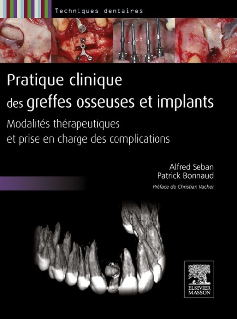 Cover image for book Pratique clinique des greffes osseuses et implants