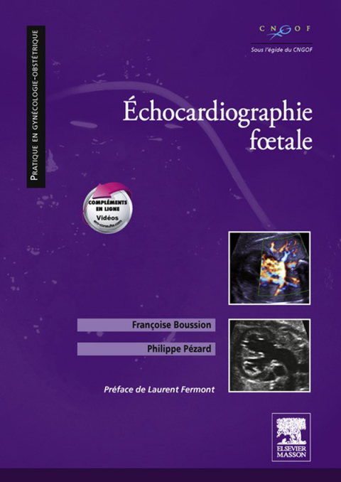 Cover image for book Echocardiographie fœtale