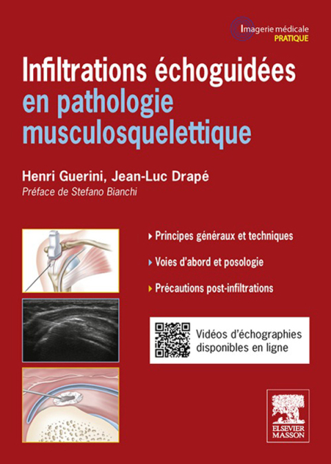 Cover image for book Infiltrations échoguidées