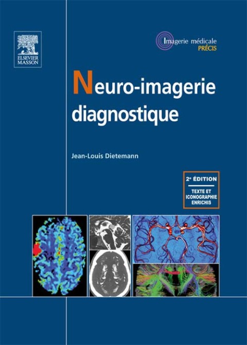 Cover image for book Neuro-imagerie diagnostique