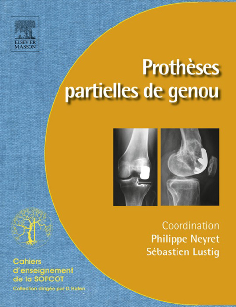 Cover image for book Prothèses partielles du genou