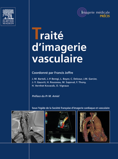 Cover image for book Traité d'imagerie vasculaire