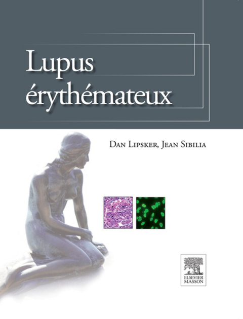 Cover image for book Lupus érythémateux