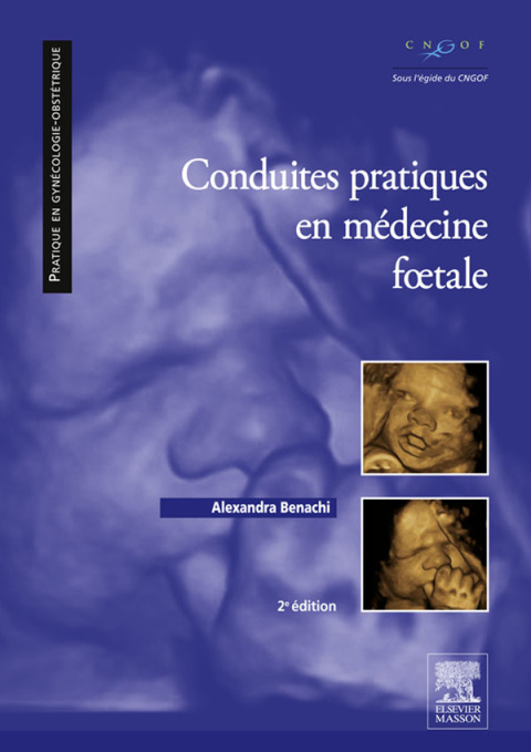 Cover image for book Conduites pratiques en médecine foetale