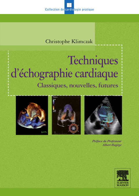 Cover image for book Techniques d'échographie cardiaque