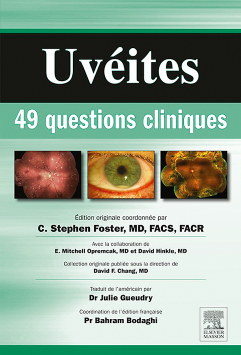 UvÃ©ites : 49 questions cliniques 