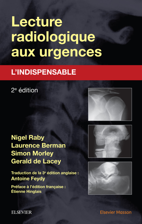 Lecture radiologique aux urgences : l'indispensable 