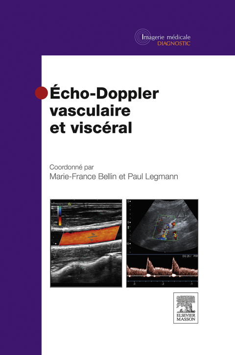 Cover image for book Echo-Doppler vasculaire et viscéral
