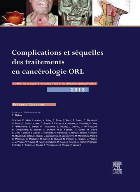 Cover image for book Complications et séquelles des traitements en cancérologie ORL