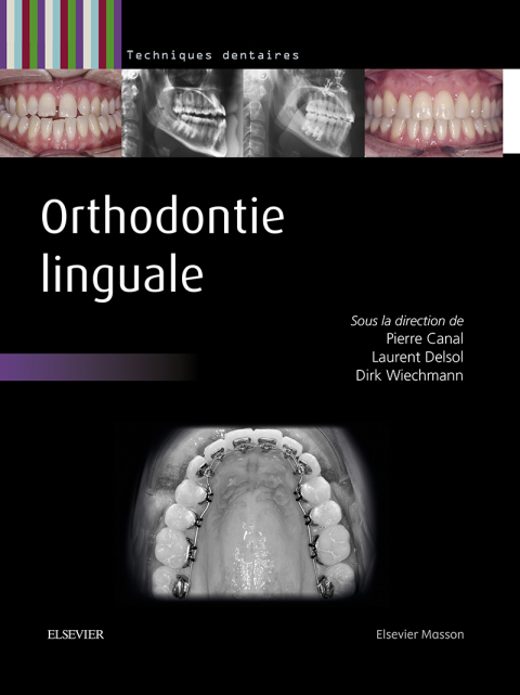 Cover image for book Orthodontie linguale