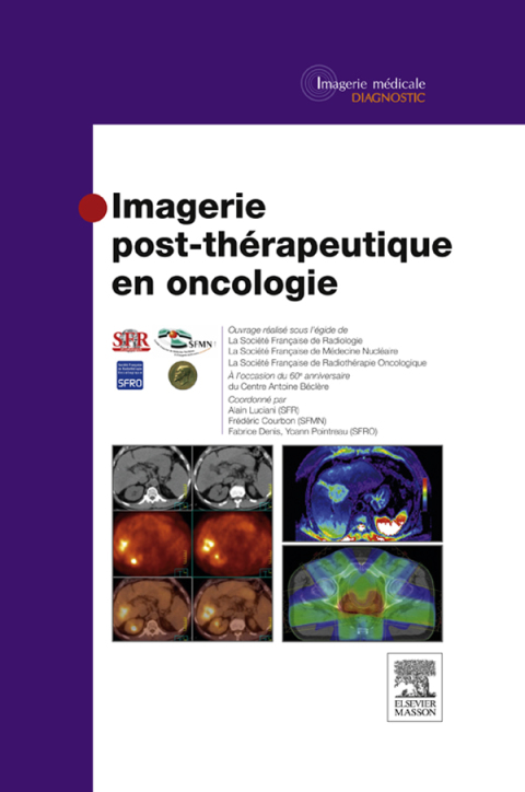 Cover image for book Imagerie post-thérapeutique en oncologie