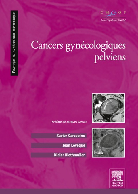 Cover image for book Cancers gynécologiques pelviens