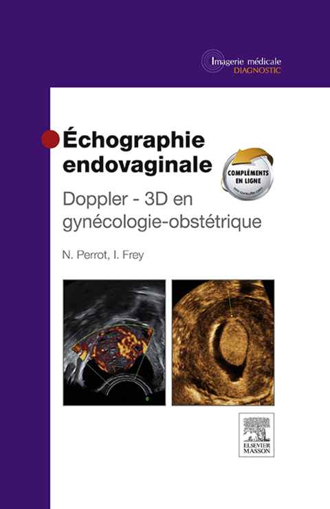 Cover image for book Échographie endovaginale Doppler - 3D