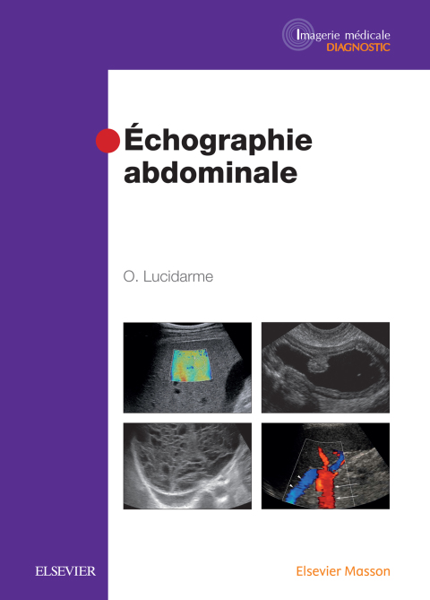 Cover image for book Echographie abdominale