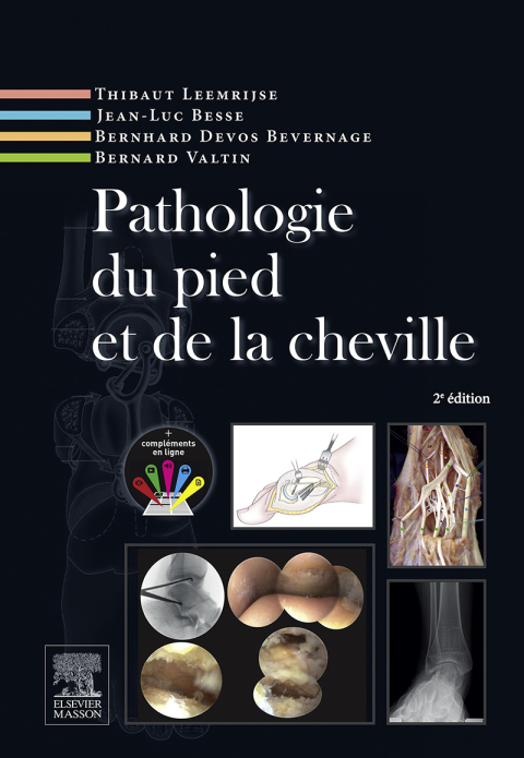 Cover image for book Pathologie du pied et de la cheville