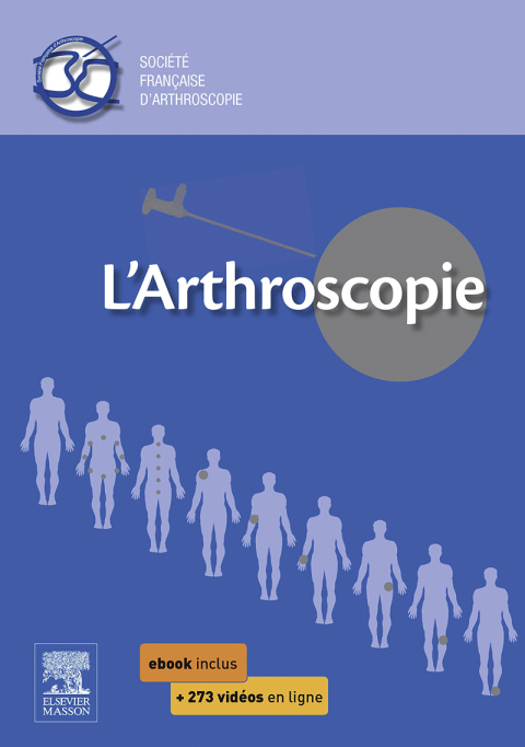 Cover image for book L'arthroscopie