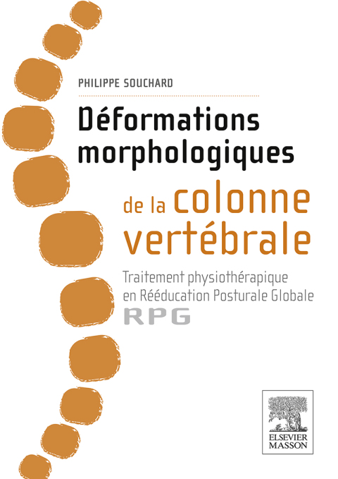 Cover image for book Déformations morphologiques de la colonne vertébrale